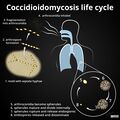 Coccidioidomycosis life cycle- diagram (Radiopaedia 43903).jpg