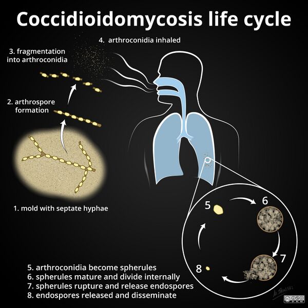 File:Coccidioidomycosis life cycle- diagram (Radiopaedia 43903).jpg