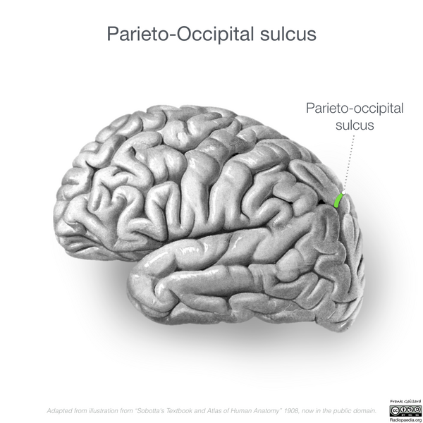 File:Neuroanatomy- lateral cortex (diagrams) (Radiopaedia 46670-51202 I 1).png