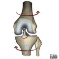 Anterior cruciate ligament injury (illustrations) (Radiopaedia 21443-21386 Figure 2 1).jpg