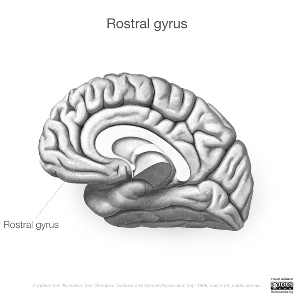 File:Neuroanatomy- medial cortex (diagrams) (Radiopaedia 47208-52697 Rostral gyrus 6).png