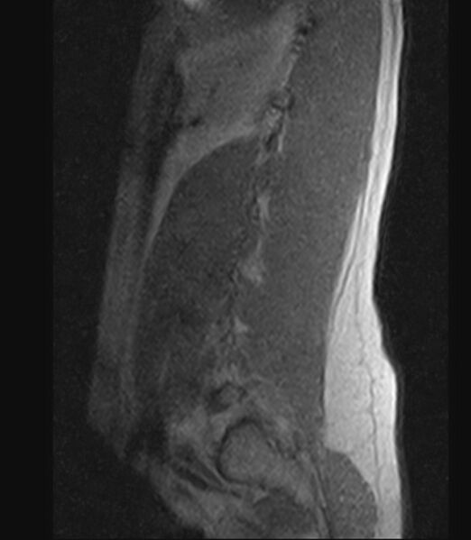 File:Normal lumbar spine MRI - low-field MRI scanner (Radiopaedia 40976-43699 Sagittal T1 1).jpg