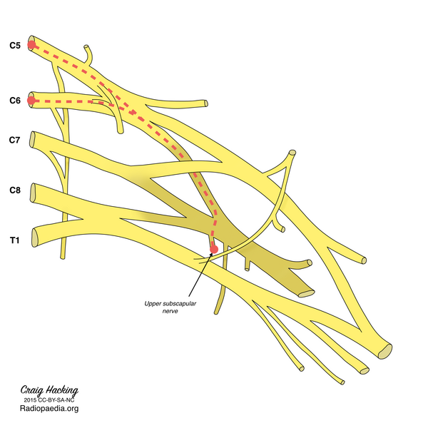 File:Brachial plexus (diagram) (Radiopaedia 37612-39492 T 1).png