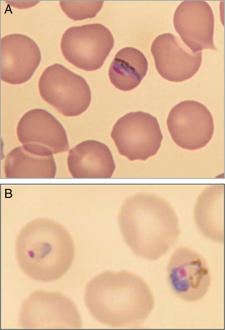 Microscopic aspect of Plasmodium knowlesi in a blood smear