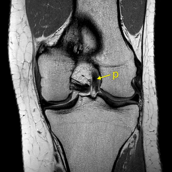 File:Anatomy Quiz (MRI knee) (Radiopaedia 43478-46874 A 18).jpeg
