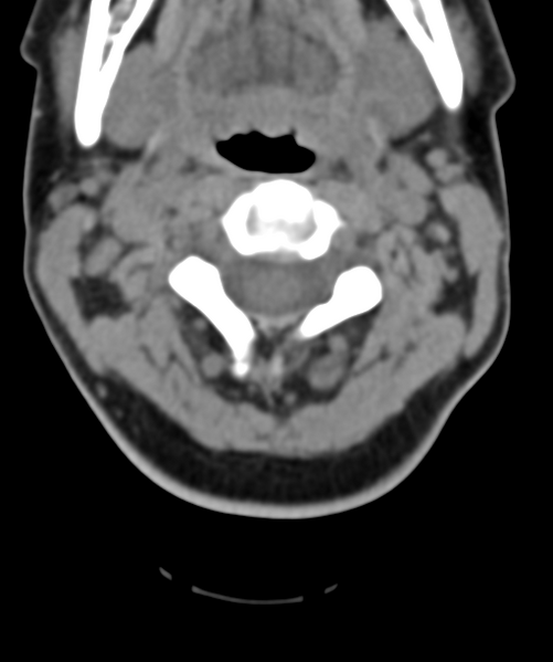 File:Normal cervical spine MRI (including Dixon) (Radiopaedia 42762-45926 Axial non-contrast 20).png