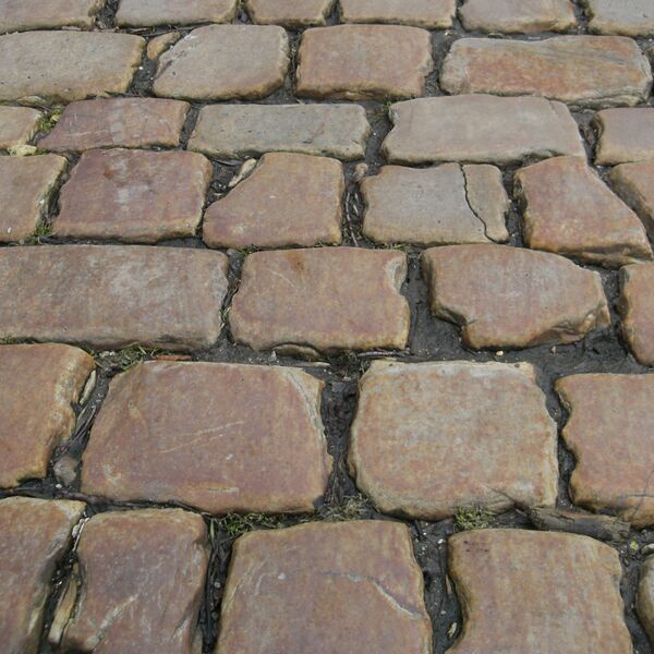 File:Cobblestones (photo) (Radiopaedia 36412).jpg