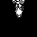 Normal CT of the neck (Radiopaedia 14575-14500 Coronal C+ 2).jpg
