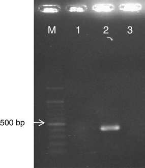 RT-PCR product (443bp) of human corona virus HKU1–specific primers, lane M, size marker (100bp); lane 1 Negative control RT-PCR mix; lane 2 HKU1