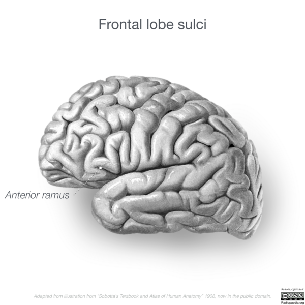 File:Neuroanatomy- lateral cortex (diagrams) (Radiopaedia 46670-51202 C 4).png