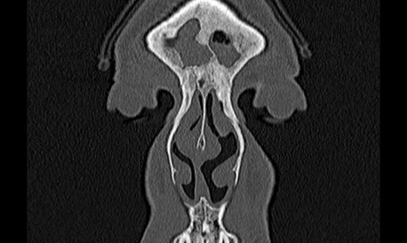 File:Chronic rhinosinusitis (Radiopaedia 65079-74075 Coronal bone window 4).jpg