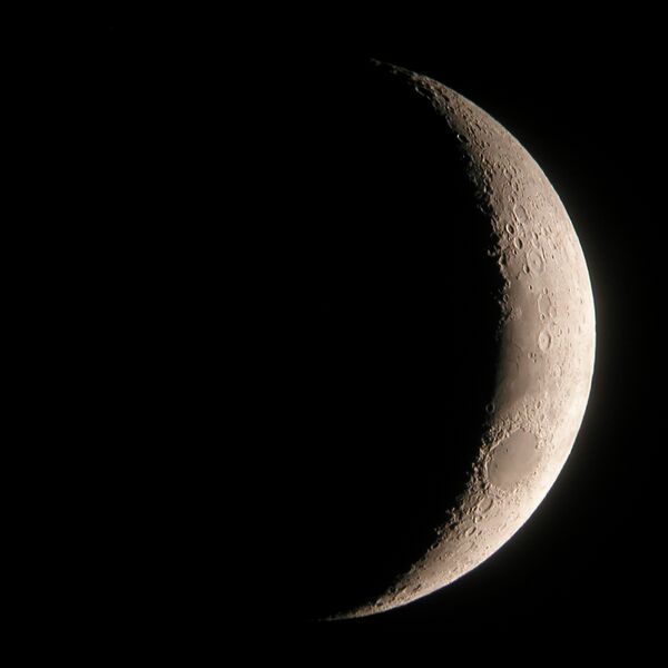 File:Crescent moon (photo) (Radiopaedia 36395).jpg