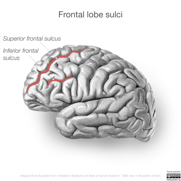 File:Neuroanatomy- lateral cortex (diagrams) (Radiopaedia 46670-51201 C 7).png