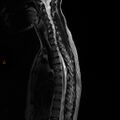 Normal spine MRI (Radiopaedia 77323-89408 E 6).jpg